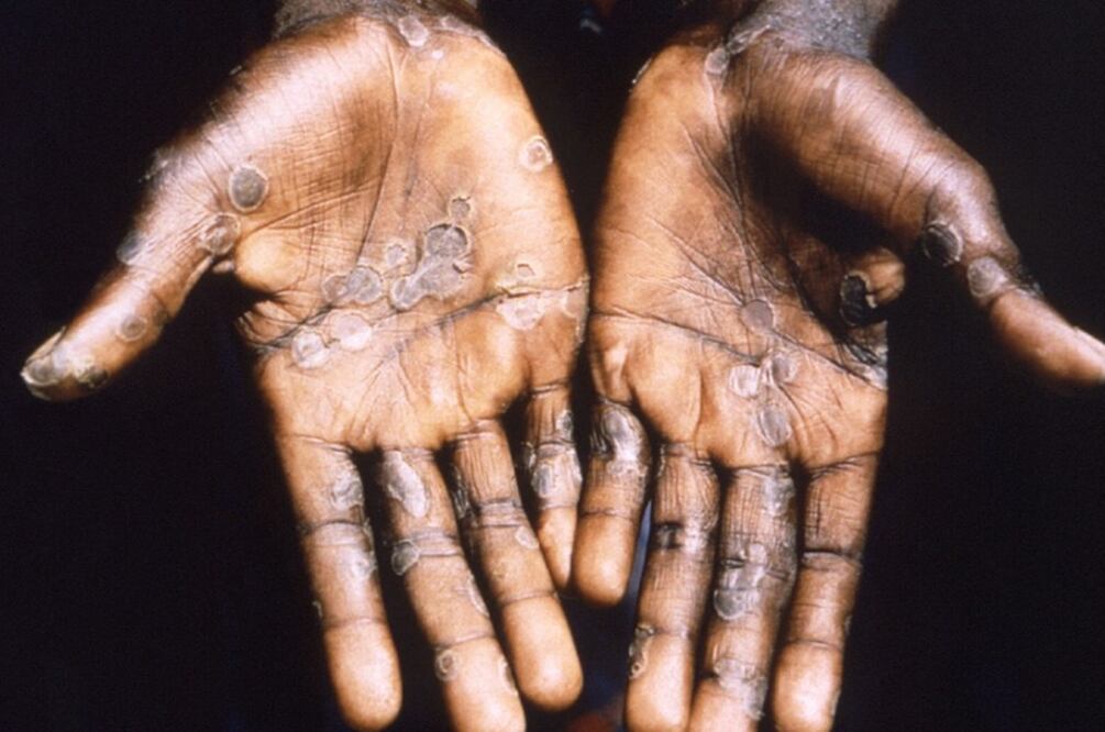 Imagen vía UNAM global