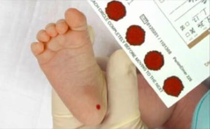 IMSS Oaxaca llama a embarazadas a realizar tamiz neonatal a recién nacidos para detectar enfermedades