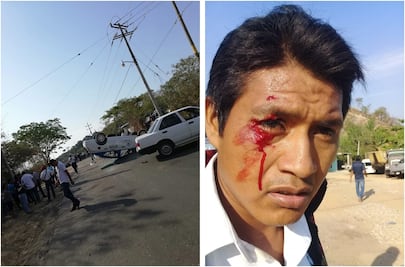 Se enfrentan transportistas en la Costa; reportero resulta herido