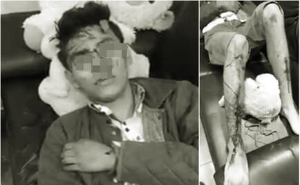 Autoridad de Huitzo pide indagar, caiga quien caiga, asesinato de joven entregado por policías para que lo lincharan