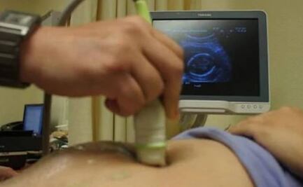 Oaxaca, octavo lugar por muertes maternas en el país en 2020; Covid-19, la causa principal