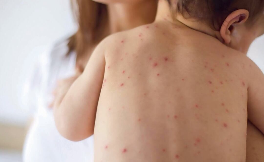 Instalan cerco sanitario en Papaloapan, Oaxaca, por caso sospechoso de Enfermedades Febriles Exantemáticas. Foto: Archivo