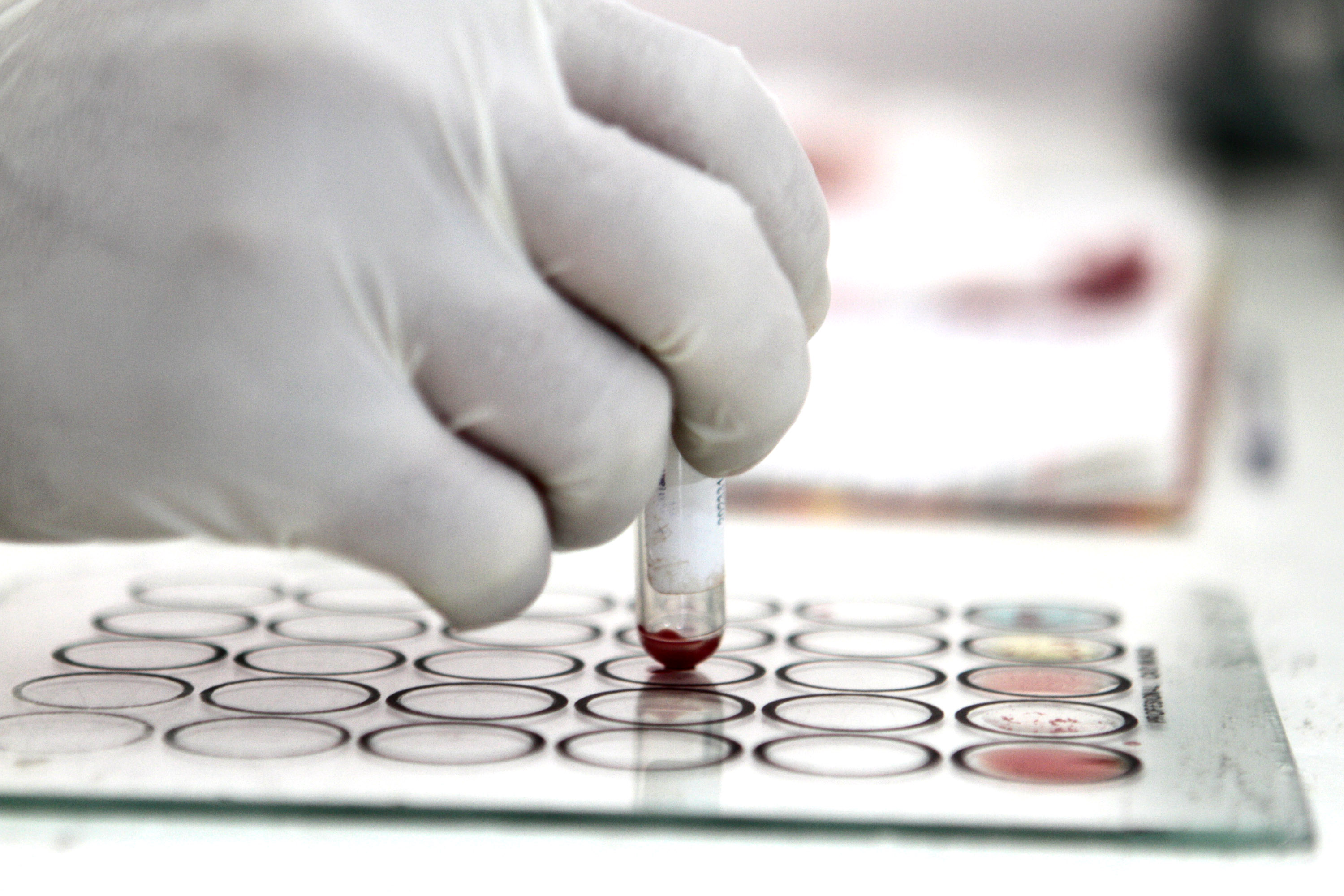 Urge CNDH a garantizar la atención para controlar la epidemia de VIH y Sida