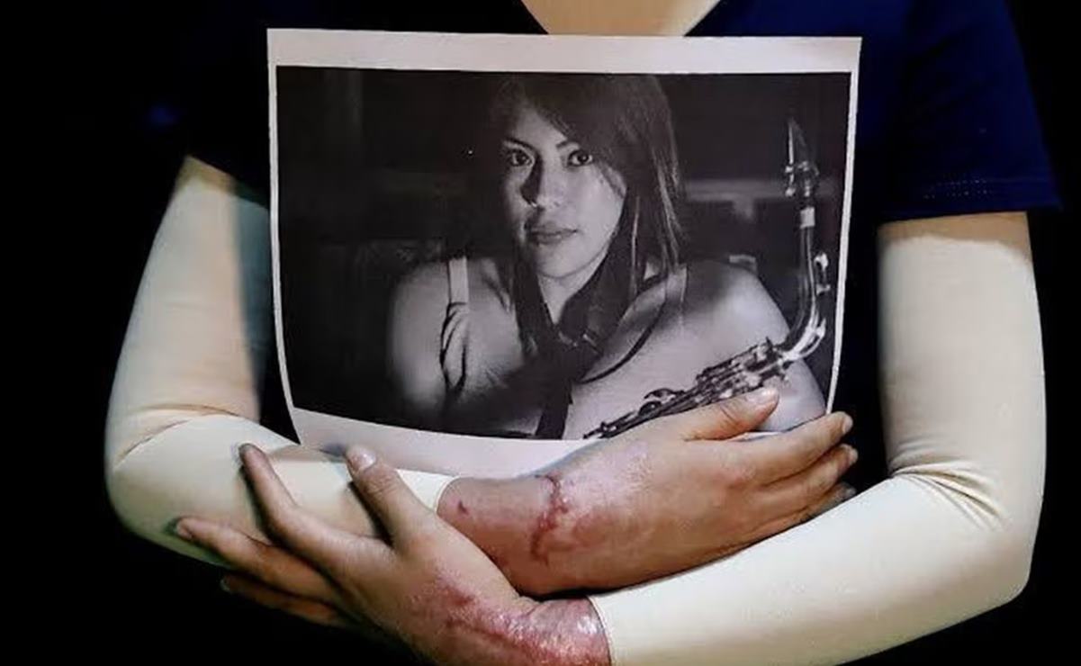 CDMX publica "Ley Malena", inspirada en saxofonista de Oaxaca; ataques con ácido serán tentativa de feminicidio. Foto: Berenice Fregoso