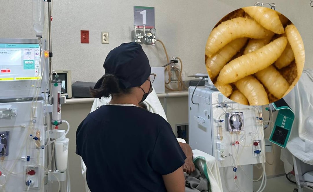 Hasta el momento no se ha informado el lugar en el que la víctima fue infectado con el gusano barrenador. Imagen ilustrativa. Foto: Especial