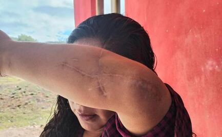 Víctima de tentativa de feminicidio advierte que juez de Oaxaca pretende dejar en libertad a su agresor