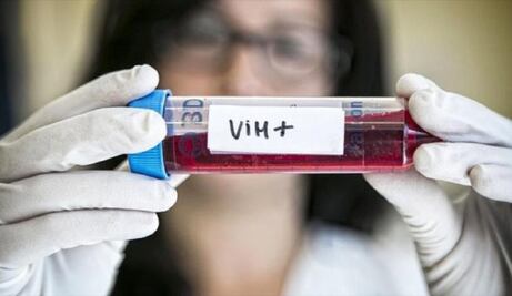 Con 189 casos nuevos de VIH en Oaxaca, Congreso exige reforzar acciones preventivas