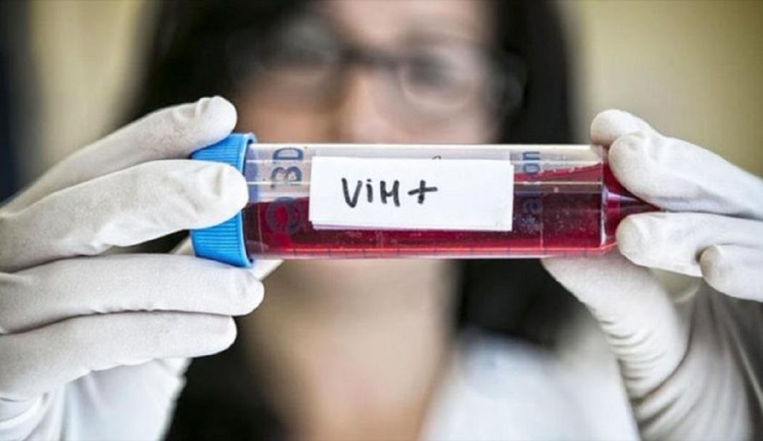 Con 189 casos nuevos de VIH en Oaxaca, Congreso exige reforzar acciones preventivas