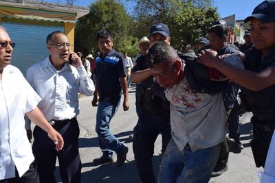 Fallece segunda autoridad baleada ayer en Tlaxiaco