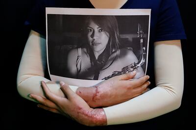 “Lastimaron mi piel, pero no mi música”