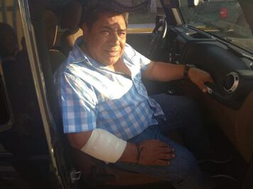 Quitan custodia policiaca a periodista que fue agredido a balazos