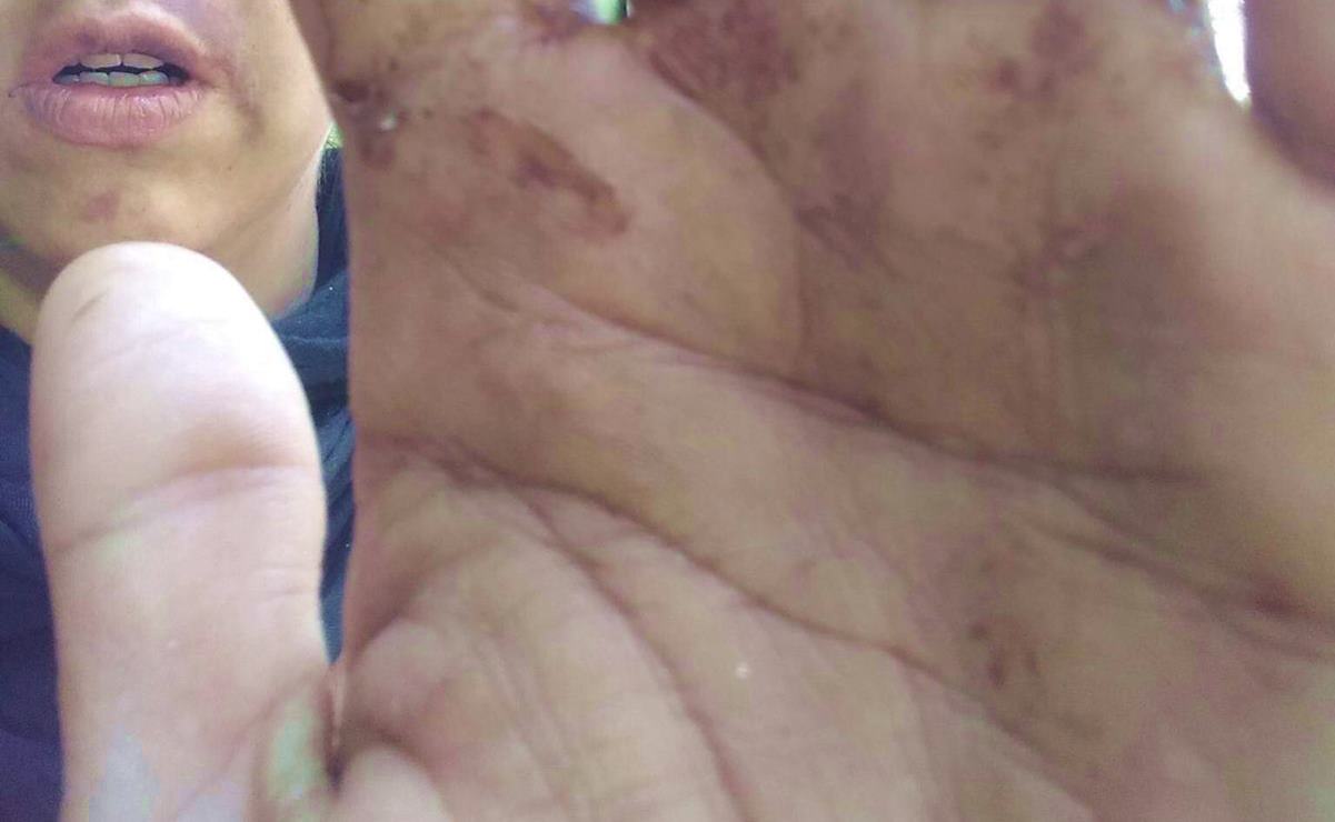 Mujer sobrevive a tentativa de feminicidio en Mazunte, Oaxaca; denuncia públicamente a su agresor. Fotos: Especiales