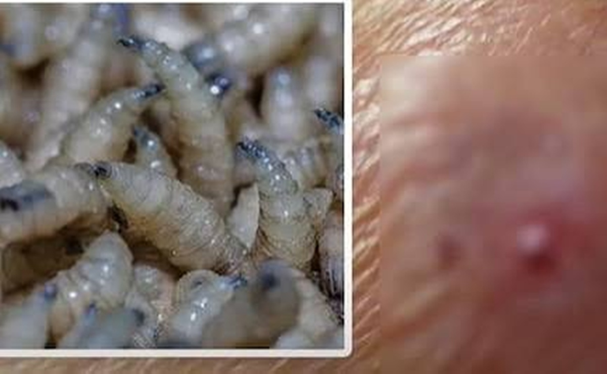 Confirman en Oaxaca dos casos de gusano barrenador del ganado en humanos