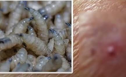 Confirman en Oaxaca dos casos de gusano barrenador del ganado en humanos