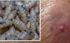 Confirman en Oaxaca dos casos de gusano barrenador del ganado en humanos