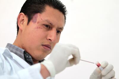 Repuntan enfermedades intestinales; se registran 100 mil casos en 2017