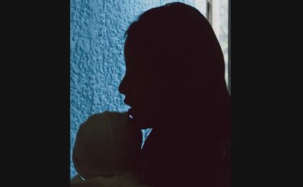 Labio leporino, cuando un mal congénito también lleva la discriminación como herencia