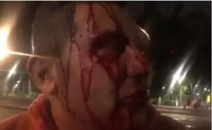 Periodistas de Reforma y TV Azteca denuncian agresión de policías en la Doctores