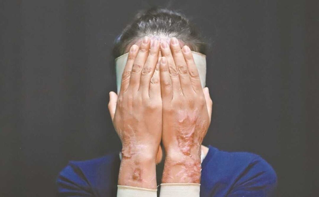 Van por hasta 15 años de cárcel a quien infrinja lesiones con ácido a mujeres. Foto: Archivo EL UNIVERSAL