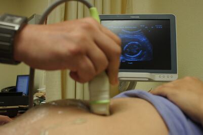 Oaxaca, entre los estados con mayor índice de mortalidad materna