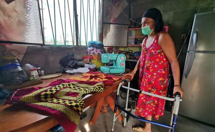 Yo fui la que perdió una pierna, reclama artesana de Oaxaca; le cobran 58 mil tras ser atropellada