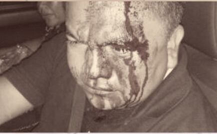 Riña en filtro sanitario de Santiago Astata deja un policía y un enfermero heridos