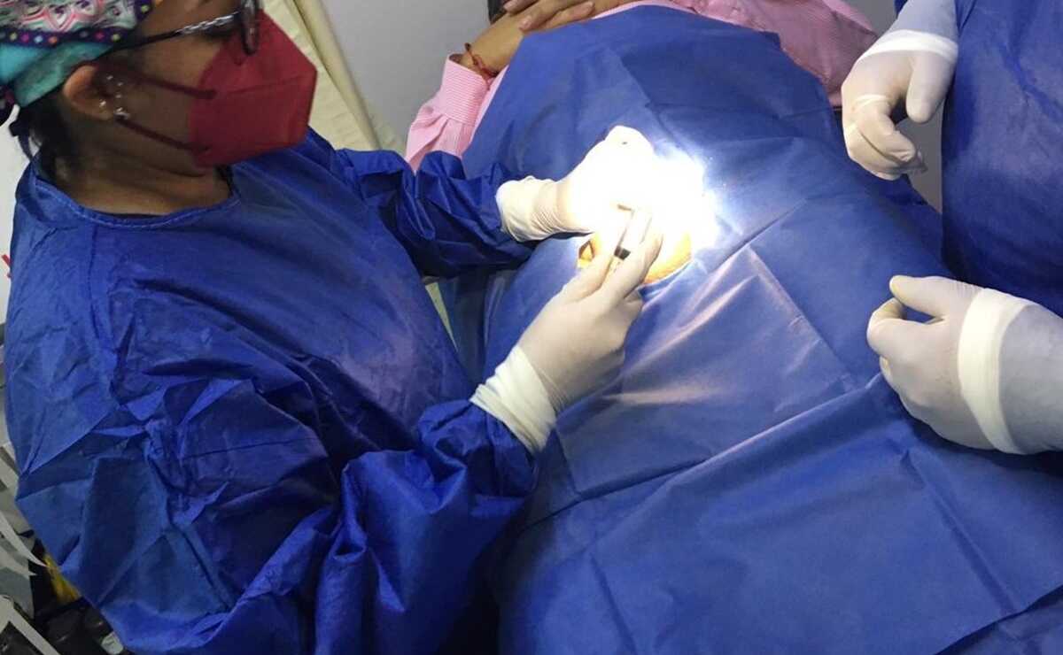 Llaman SSO a hombres de Tuxtepec a realizarse vasectomía sin bisturí. Foto: Especial