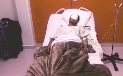 Autoridades comunales de Yosoñama reportan ataque armado; hay tres heridos
