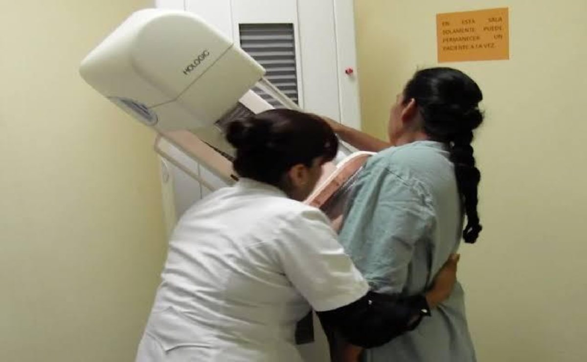 Suman 60 muertes por cáncer de mamá en Oaxaca este 2020: SSO